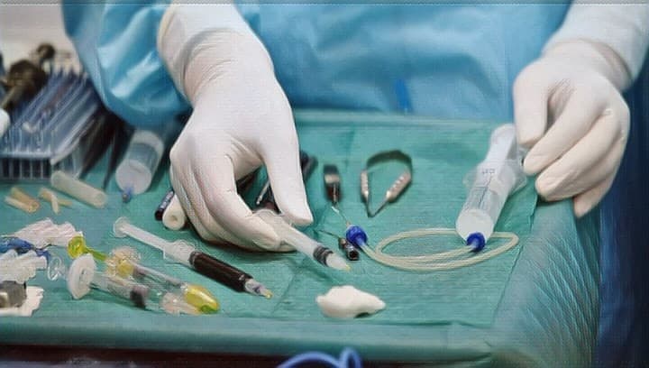 Техника проведения имплантации